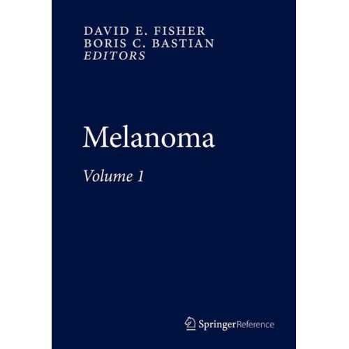 Melanoma