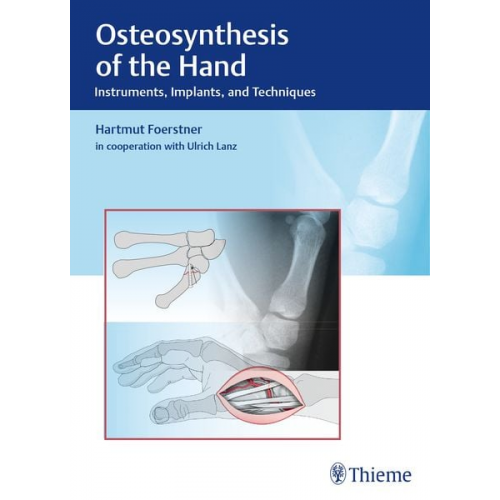 Hartmut Förstner - Osteosynthesis of the Hand