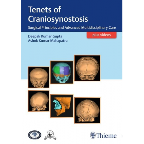 Tenets of Craniosynostosis