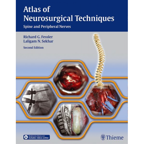 Atlas of Neurosurgical Techniques