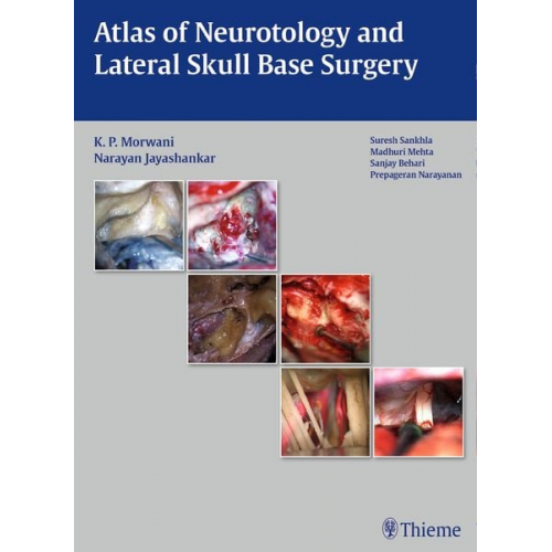 Atlas of Neurotology and Lateral Skull Base Surgery