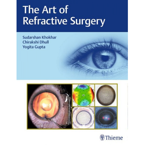 The Art of Refractive Surgery