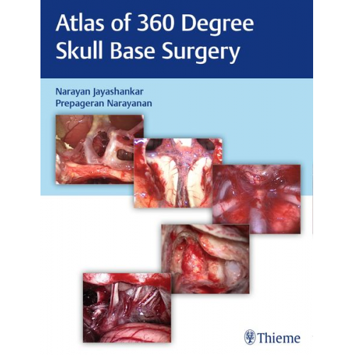 Atlas of 360 Degree Skull Base Surgery