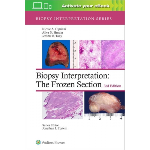 Nicole A. Cipriani Aliya N. Husain Jerome B. Taxy - Biopsy Interpretation: The Frozen Section: Print + eBook with Multimedia