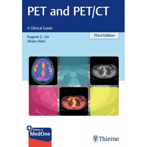 Eugene C. Lin Abass Alavi - Pet and Pet/ct