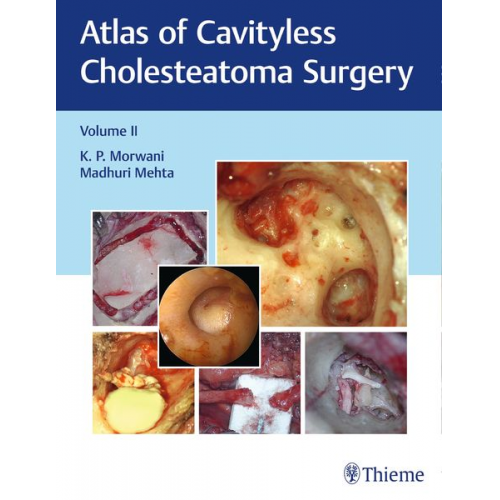 K. Morwani Madhuri Mehta - Atlas of Cavityless Cholesteatoma Surgery, Vol 2