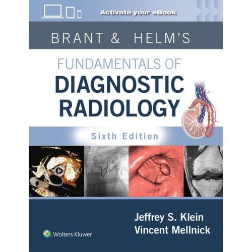 Jeffrey Klein Vincent Mellnick - Brant & Helm's Fundamentals of Diagnostic Radiology: Print + eBook with Multimedia