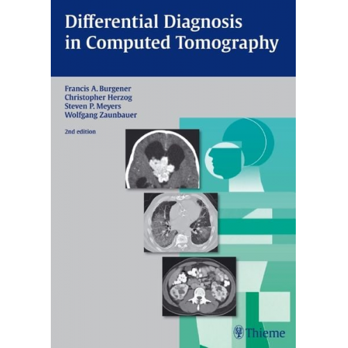 Francis A. Burgener Christopher Herzog Steven Meyers Wolfgang Zaunbauer - Differential Diagnosis in Computed Tomography