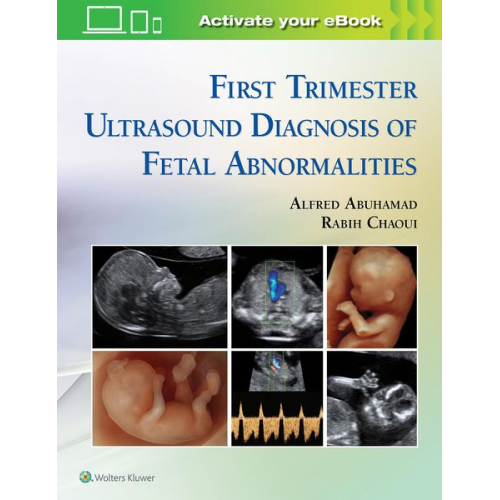 Alfred Abuhamad Rabih Chaoui - First Trimester Ultrasound Diagnosis of Fetal Abnormalities