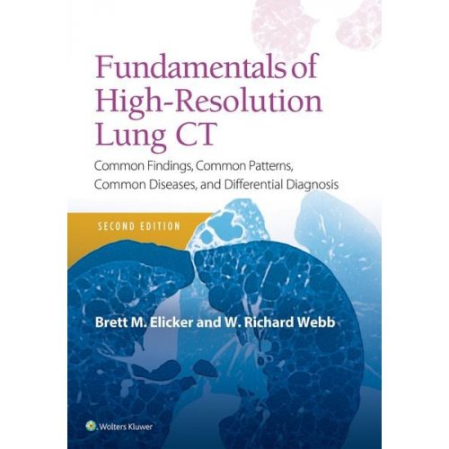 Brett M. Elicker W. Richard Webb - Fundamentals of High-Resolution Lung CT