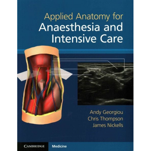 Andy Georgiou Chris Thompson James Nickells - Applied Anatomy for Anaesthesia and Intensive Care