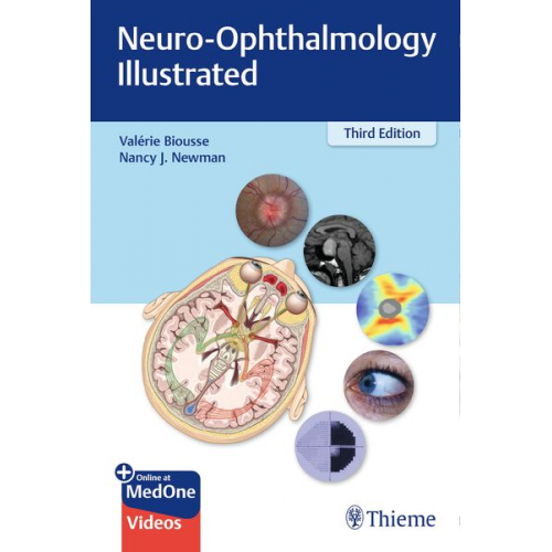 Valerie Biousse Nancy Newman - Neuro-Ophthalmology Illustrated