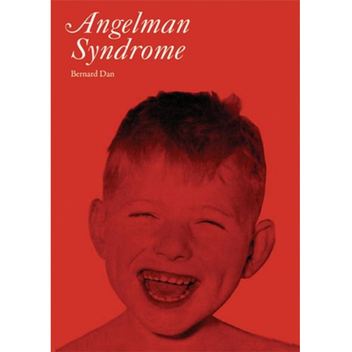 Bernard Dan - Angelman Syndrome