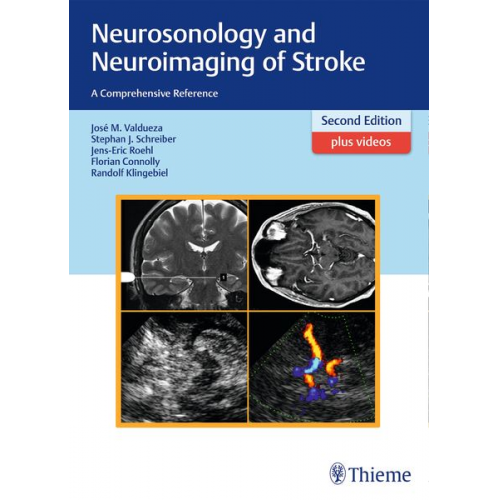 José Manuel Valdueza Stephan Schreiber Jens-Eric Röhl Florian Connolly Randolf Klingebiel - Neurosonology and Neuroimaging of Stroke