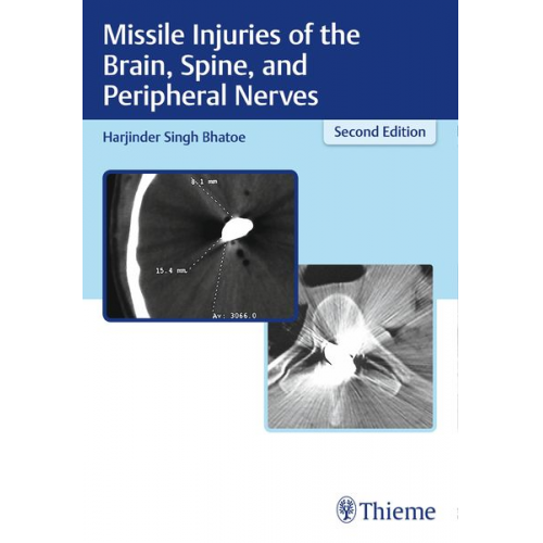 Harjinder S. Bhatoe - Missile Injuries of the Brain, Spine, and Peripheral Nerves