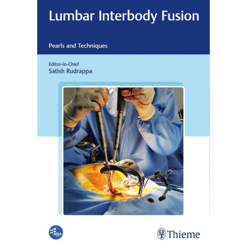 Lumbar Interbody Fusion