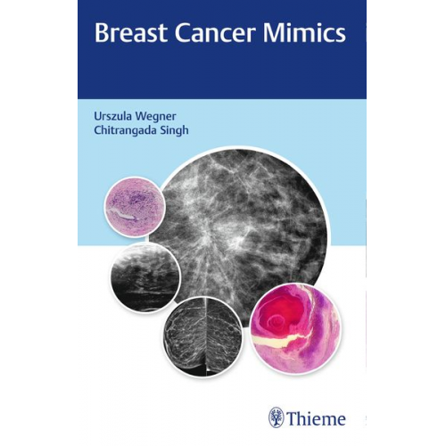 Urszula Wegner Chitrangada Singh - Breast Cancer Mimics