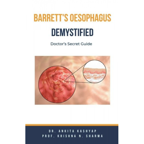 Ankita Kashyap Krishna N. Sharma - Barretts Oesophagus Demystified