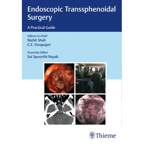 Endoscopic Transsphenoidal Surgery