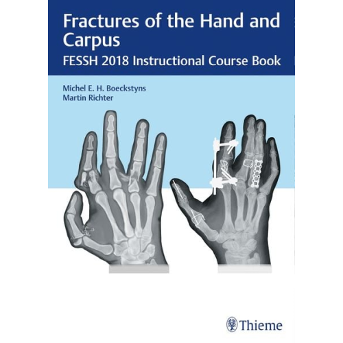 Fractures of the Hand and Carpus