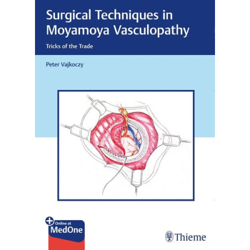 Peter Vajkoczy - Surgical Techniques in Moyamoya Vasculopathy