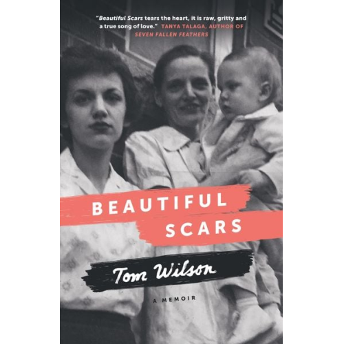 Tom Wilson - Beautiful Scars